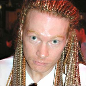 axl_rose_after_plastic_surgery.jpg-764330.jpg